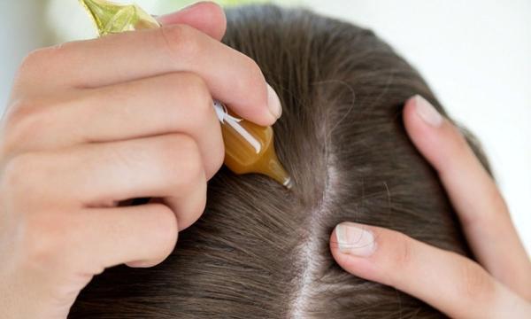 معجزه روغن سویا برای رویش موی سر معجزه روغن سویا برای رویش موی سر